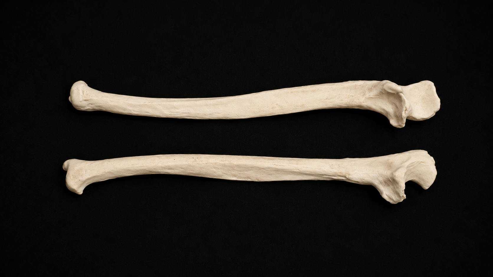 Ulna