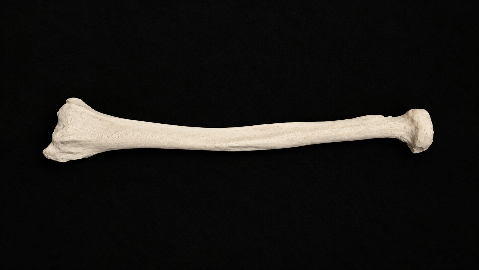 Radius