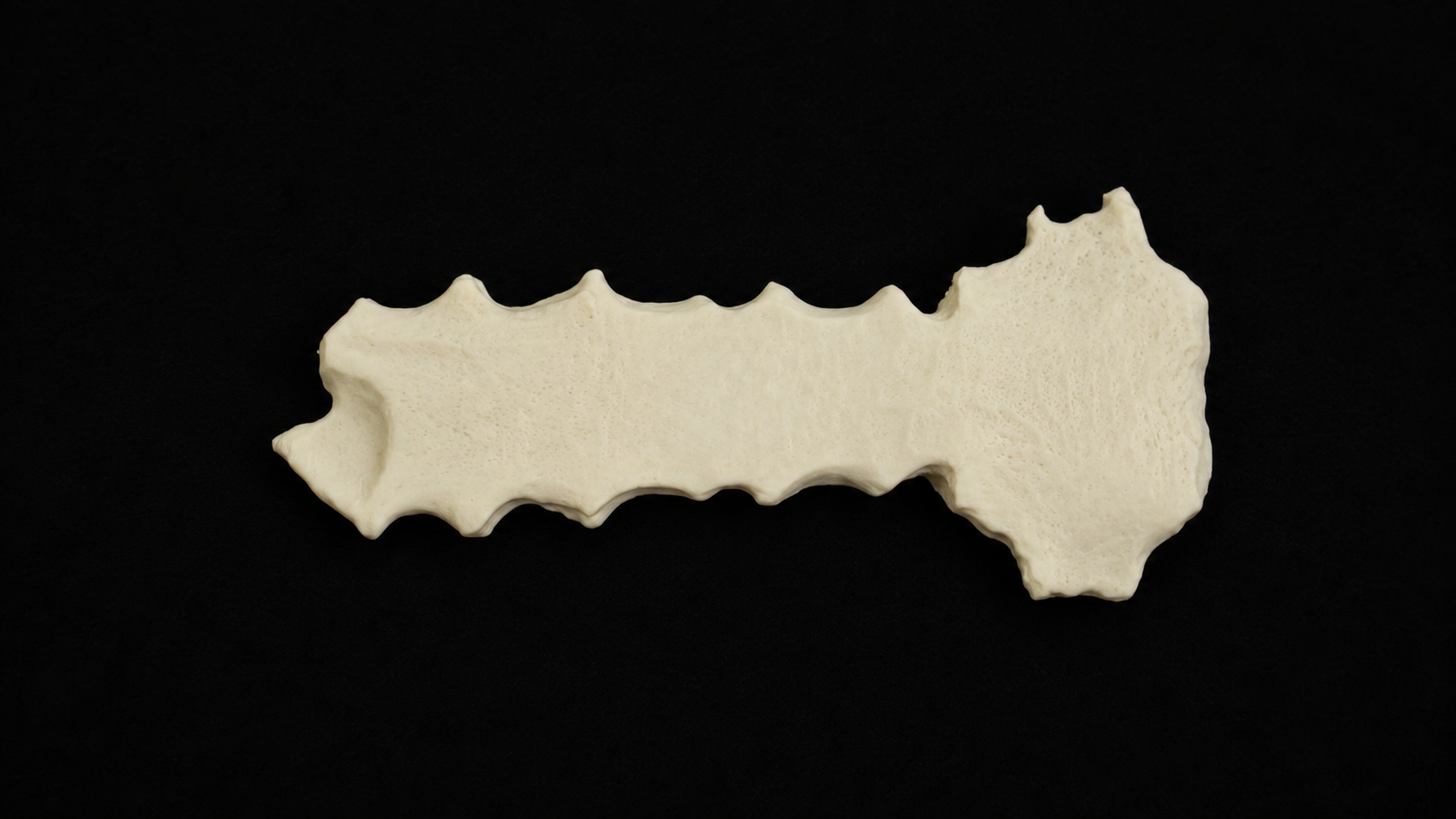 Sternum